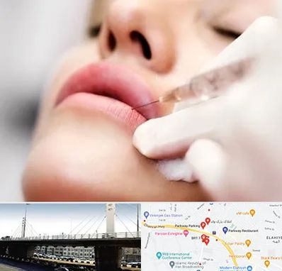 کلینیک تزریق ژل لب در پارک وی