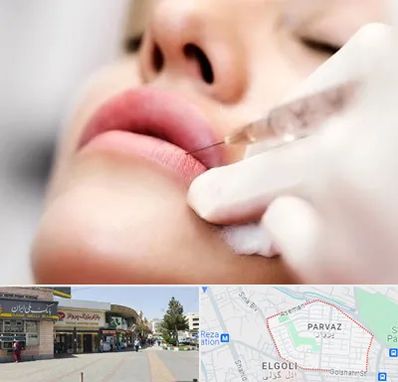 کلینیک تزریق ژل لب در پرواز تبریز