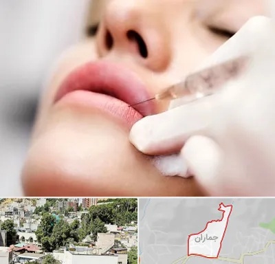 کلینیک تزریق ژل لب در جماران