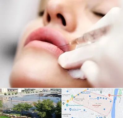 کلینیک تزریق ژل لب در گلستان اهواز
