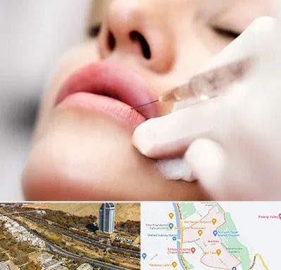 کلینیک تزریق ژل لب در خیابان نیایش شیراز