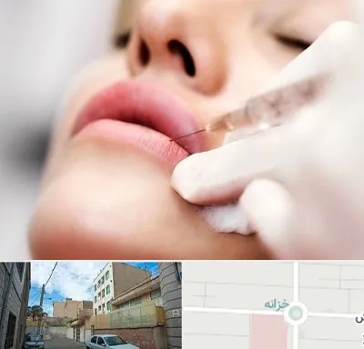 کلینیک تزریق ژل لب در خزانه