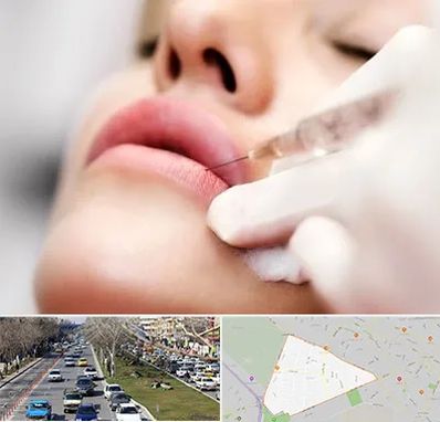 کلینیک تزریق ژل لب در احمدآباد مشهد