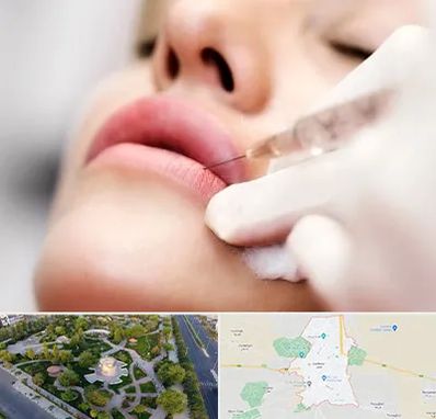 کلینیک تزریق ژل لب در کاشمر