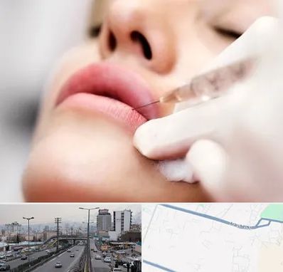 کلینیک تزریق ژل لب در بلوار ارتش