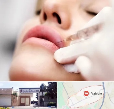 کلینیک تزریق ژل لب در وحیدیه شهریار