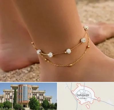 فروشگاه پابند در دهدشت