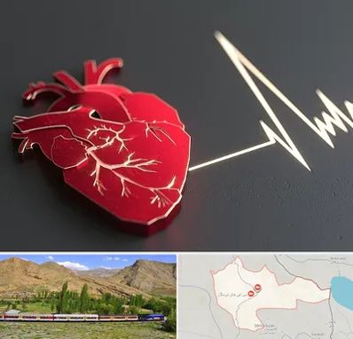 متخصص الکتروفیزیولوژی در خاش