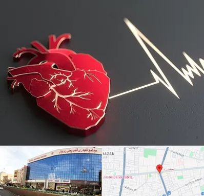 متخصص الکتروفیزیولوژی در نصف راه تبریز