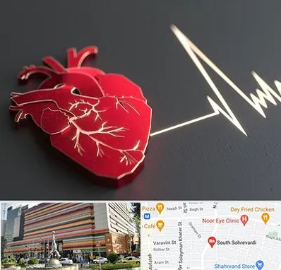 متخصص الکتروفیزیولوژی در سهروردی