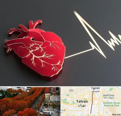 متخصص الکتروفیزیولوژی در ولیعصر