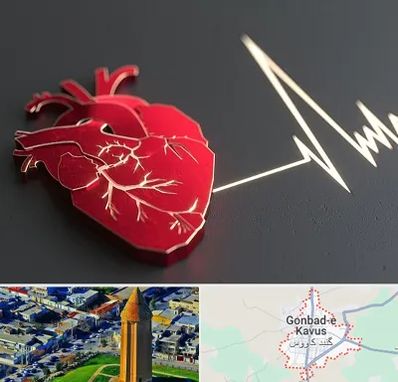 متخصص الکتروفیزیولوژی در گنبد کاووس