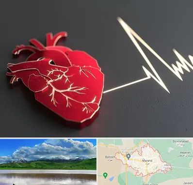 متخصص الکتروفیزیولوژی در مرند