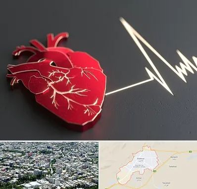 متخصص الکتروفیزیولوژی در شاهرود