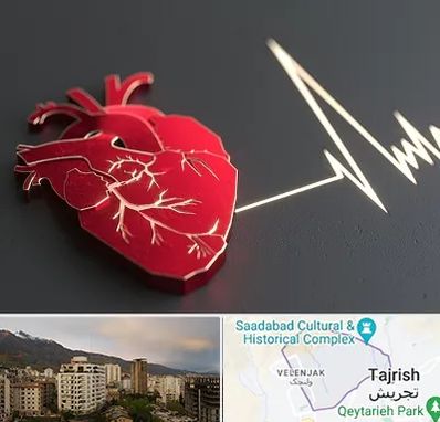 متخصص الکتروفیزیولوژی در زعفرانیه