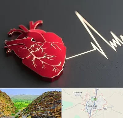 متخصص الکتروفیزیولوژی در کامیاران