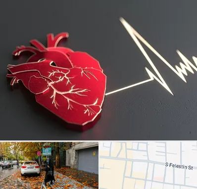 متخصص الکتروفیزیولوژی در خیابان فلسطین