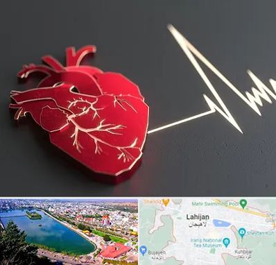 متخصص الکتروفیزیولوژی در لاهیجان