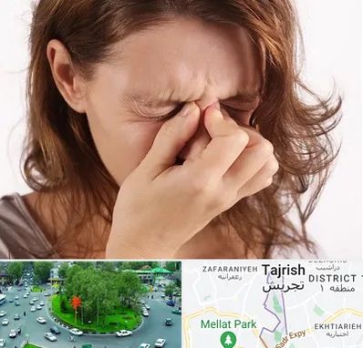 جراح برداشتن پولیپ در تجریش