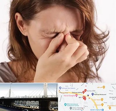 جراح برداشتن پولیپ در پارک وی