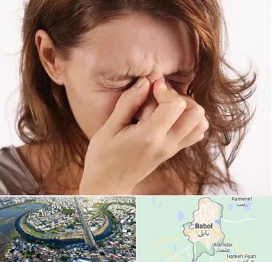 جراح برداشتن پولیپ در بابل