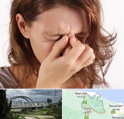 جراح برداشتن پولیپ در چالوس