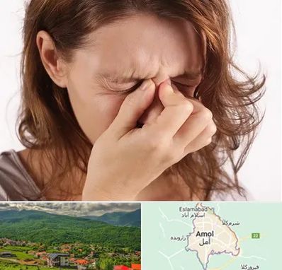 جراح برداشتن پولیپ در آمل