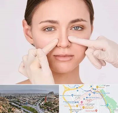 جراح راینوپلاستی در معالی آباد شیراز