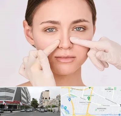 جراح راینوپلاستی در بلوار فردوس