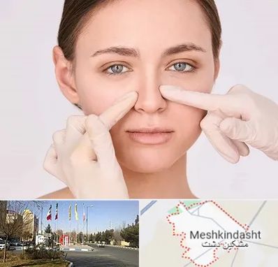 جراح راینوپلاستی در مشکین دشت