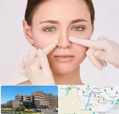 جراح راینوپلاستی در صیاد شیرازی مشهد