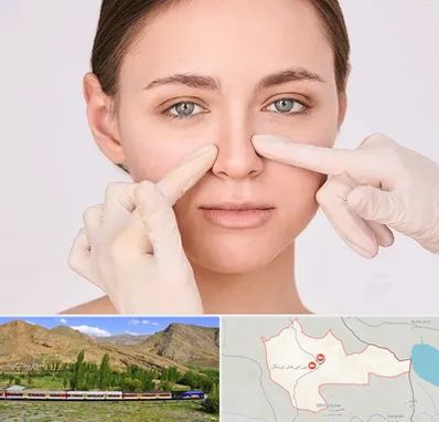 جراح راینوپلاستی در خاش