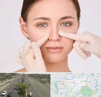 جراح راینوپلاستی در منطقه 17 تهران