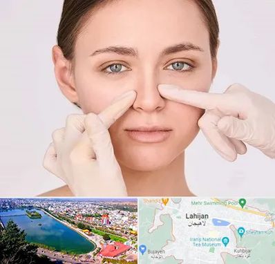 جراح راینوپلاستی در لاهیجان