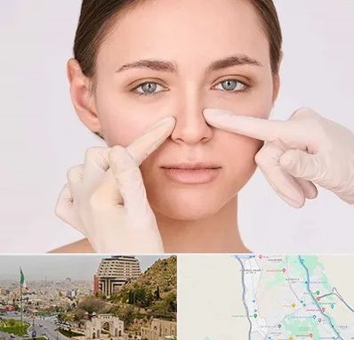 جراح راینوپلاستی در فرهنگ شهر شیراز