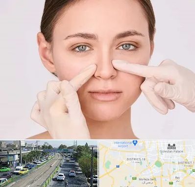 جراح راینوپلاستی در جنوب تهران