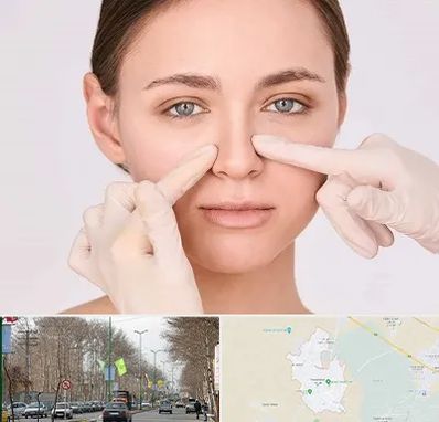 جراح راینوپلاستی در نظرآباد کرج