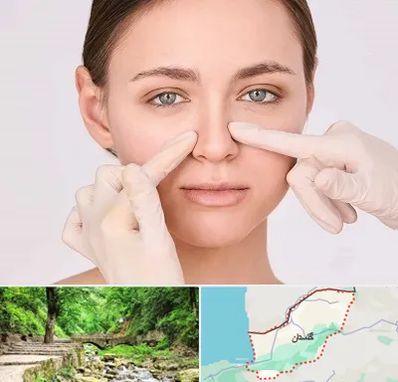 جراح راینوپلاستی در گلستان
