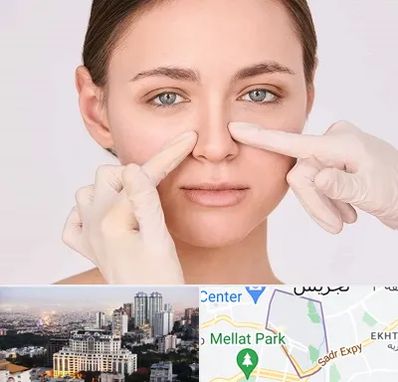 جراح راینوپلاستی در الهیه