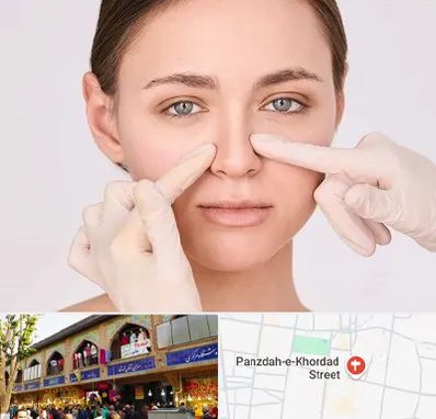 جراح راینوپلاستی در 15 خرداد