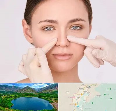 جراح راینوپلاستی در رودبار