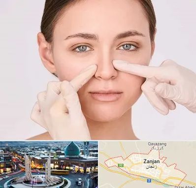 جراح راینوپلاستی در زنجان