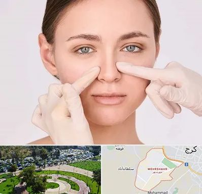 جراح راینوپلاستی در مهرشهر کرج