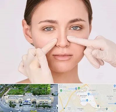 جراح راینوپلاستی در نسیم شهر