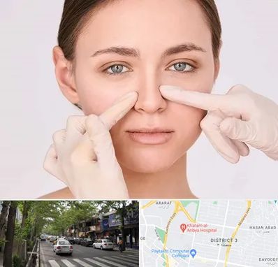 جراح راینوپلاستی در ظفر