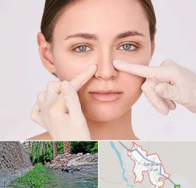جراح راینوپلاستی در سراوان