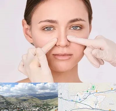 جراح راینوپلاستی در رودهن