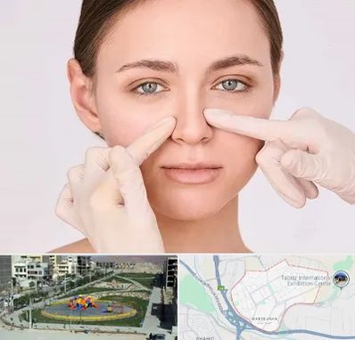 جراح راینوپلاستی در مرزداران تبریز
