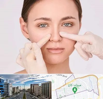 جراح راینوپلاستی در سعادت آباد