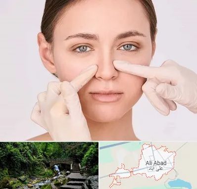 جراح راینوپلاستی در علی‌ آباد کتول